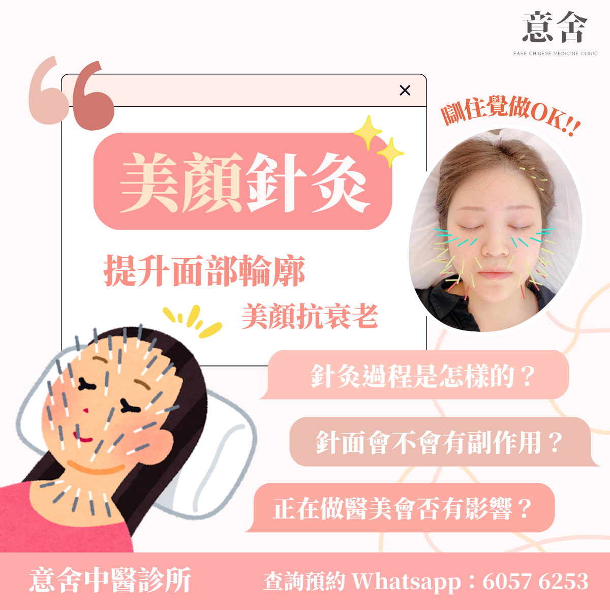 美顏針灸功效
