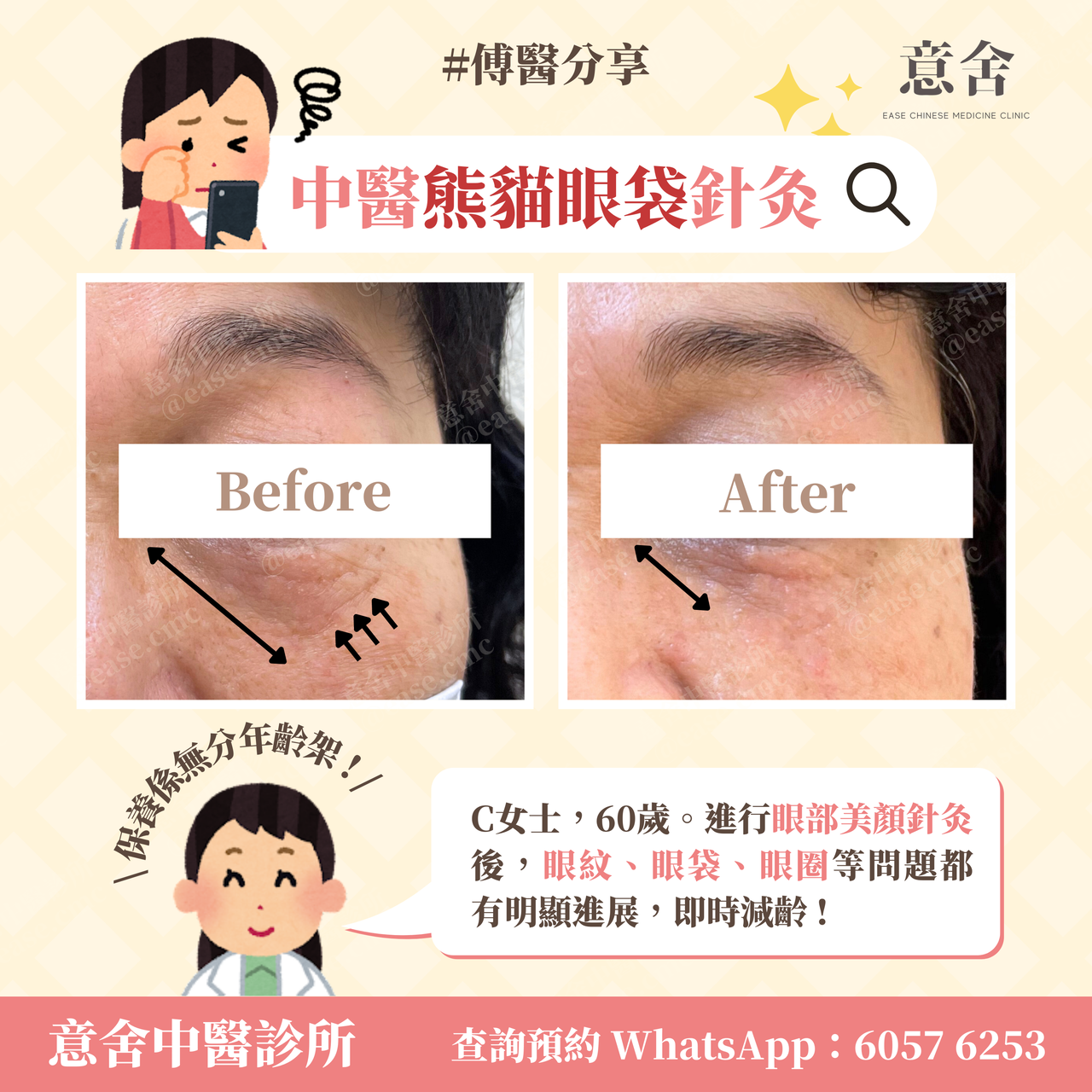 中醫熊貓針灸