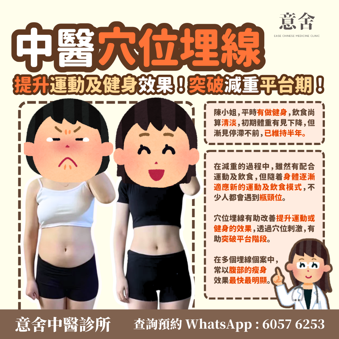 穴位埋線案例