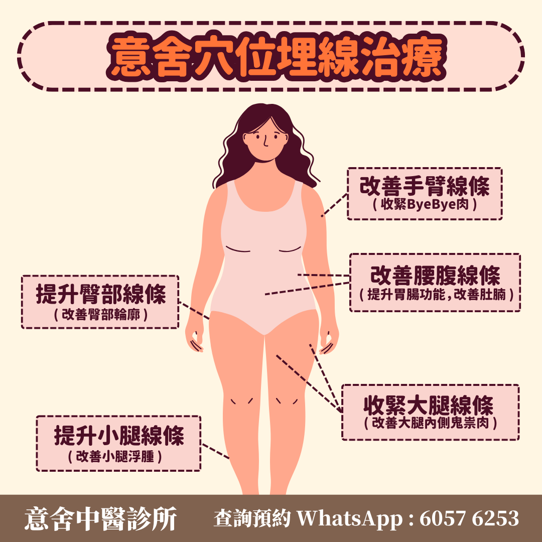 穴位埋線適用的身體部位