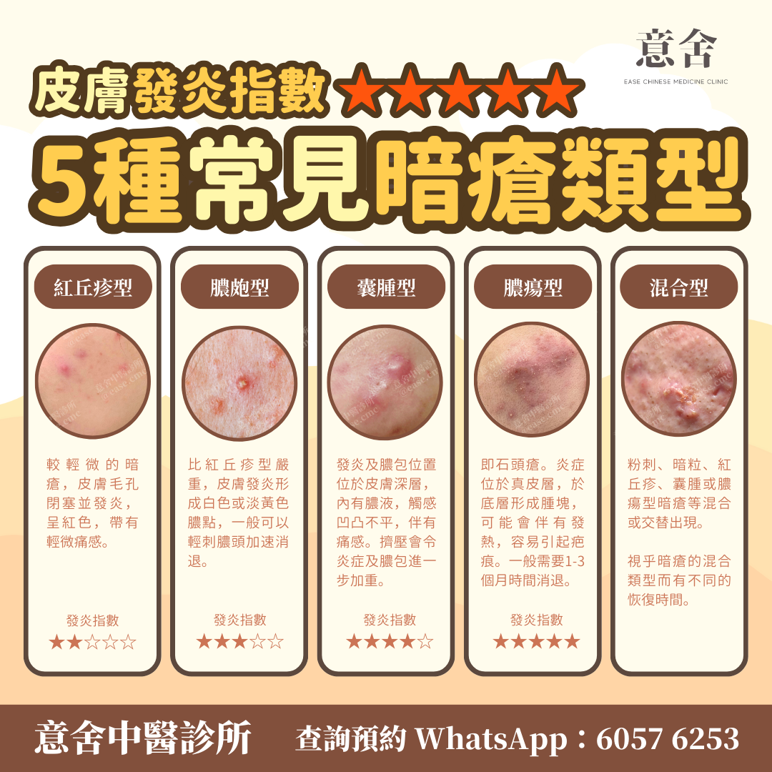 暗瘡中醫治療 | 大量暗瘡治理成功案例 - 意舍中醫診所