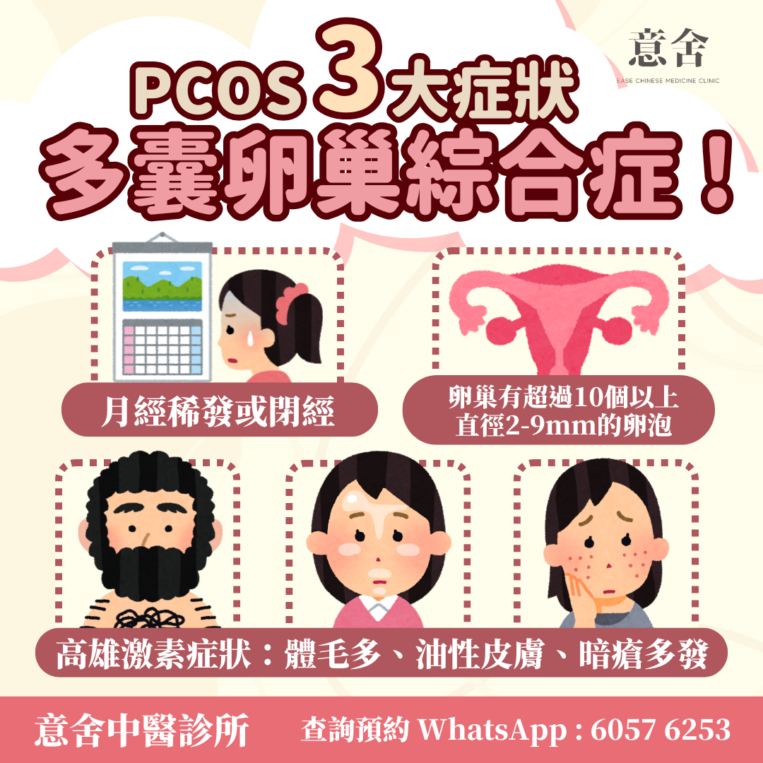 多囊卵巢綜合症