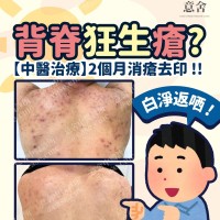 背部生暗瘡