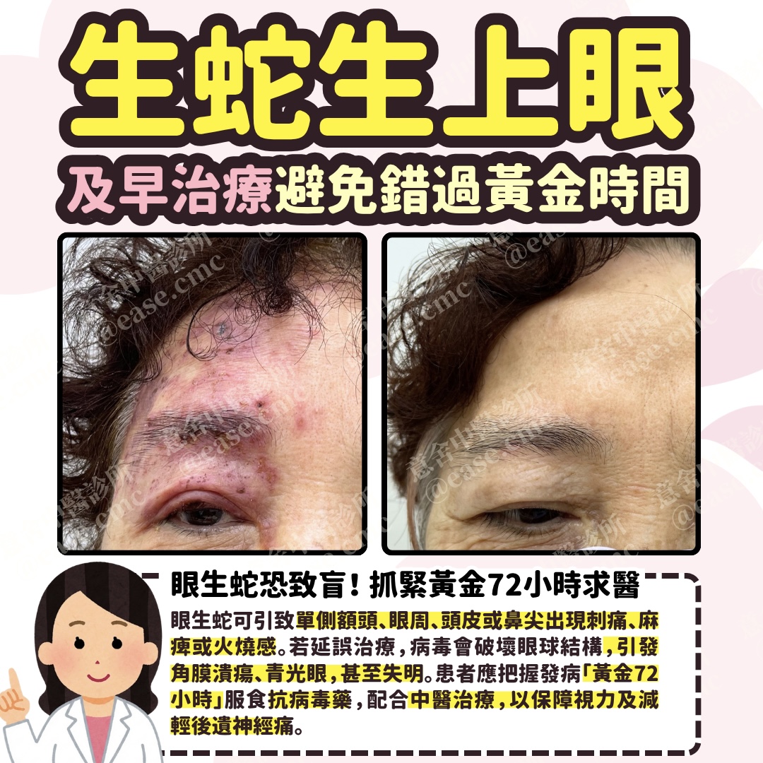 生蛇