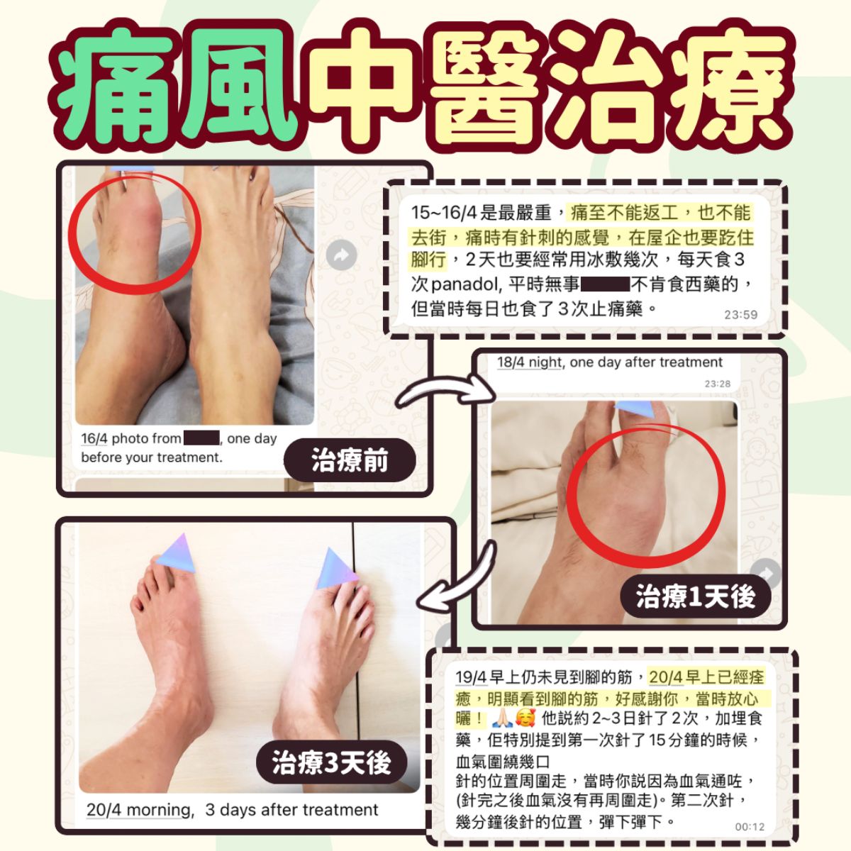 痛風中醫治療